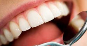 8 thói quen sai lầm khiến răng bị ố vàng