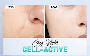 Công Nghệ Cell-Active – Giải Pháp Ưu Việt Cho Làn Da Trẻ Trung Và Mịn Màng