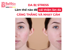 Da Bị Stress: Làm Thế Nào Để Cải Thiện Làn Da Căng Thẳng Và Nhạy Cảm?